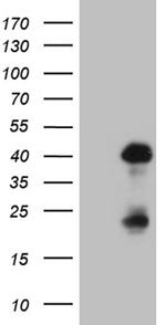 OTX2 Antibody in Western Blot (WB)