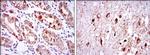 OTX2 Antibody in Immunohistochemistry (Paraffin) (IHC (P))