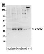 OVCOV1 Antibody in Western Blot (WB)