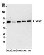 OXCT1 Antibody in Western Blot (WB)