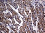 OXSM Antibody in Immunohistochemistry (Paraffin) (IHC (P))