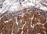 OXSM Antibody in Immunohistochemistry (Paraffin) (IHC (P))