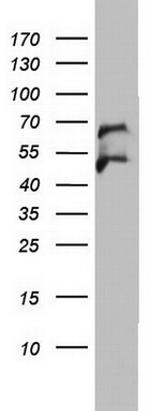 OXSM Antibody in Western Blot (WB)