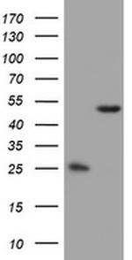 OXSM Antibody in Western Blot (WB)