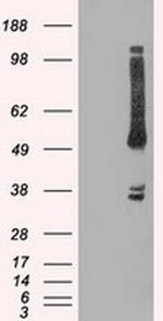 OXSR1 Antibody in Western Blot (WB)