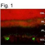 Opsin 4 Antibody in Immunocytochemistry (ICC/IF)