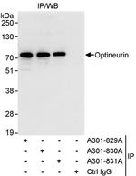 Optineurin Antibody in Immunoprecipitation (IP)