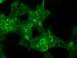 P16 Antibody in Immunocytochemistry (ICC/IF)