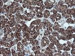 P16 Antibody in Immunohistochemistry (Paraffin) (IHC (P))