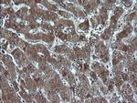 P16 Antibody in Immunohistochemistry (Paraffin) (IHC (P))