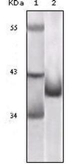 p16INK4a Antibody in Western Blot (WB)