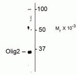 OLIG2 Antibody in Western Blot (WB)