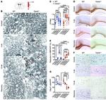 OLIG2 Antibody in Immunohistochemistry (IHC)