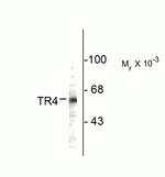 NR2C2 Antibody in Western Blot (WB)