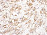 P23 Antibody in Immunohistochemistry (IHC)