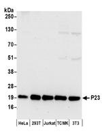 P23 Antibody in Western Blot (WB)