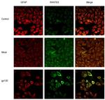 CCL5 (RANTES) Antibody in Immunocytochemistry (ICC/IF)