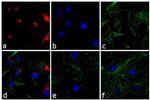 Rabbit IgG (H+L) Secondary Antibody in Immunocytochemistry (ICC/IF)