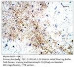 P2Y12 Antibody in Immunohistochemistry (IHC)