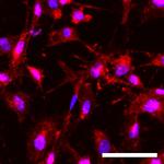 P2Y12 Antibody in Immunocytochemistry (ICC/IF)