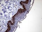 P4HA3 Antibody in Immunohistochemistry (Paraffin) (IHC (P))