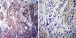 HSP27 Antibody in Immunohistochemistry (Paraffin) (IHC (P))