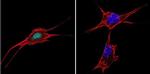 NFAT5 Antibody in Immunocytochemistry (ICC/IF)