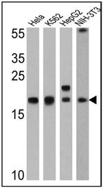 Cyclophilin A Antibody in Western Blot (WB)