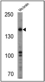 nNOS Antibody in Western Blot (WB)