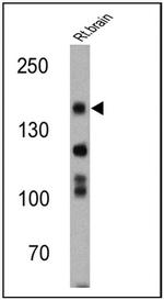 nNOS Antibody in Western Blot (WB)