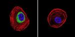 iNOS Antibody in Immunocytochemistry (ICC/IF)