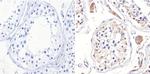 ADORA2A Antibody in Immunohistochemistry (Paraffin) (IHC (P))