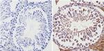 ADORA2A Antibody in Immunohistochemistry (Paraffin) (IHC (P))