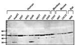 beta-1 Adrenergic Receptor Antibody in Western Blot (WB)