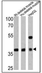 Adiponectin Receptor 1 Antibody in Western Blot (WB)