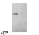 EEA1 Antibody in Western Blot (WB)