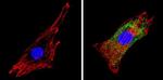 COPII Antibody in Immunocytochemistry (ICC/IF)