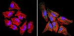 RAC1 Antibody in Immunocytochemistry (ICC/IF)