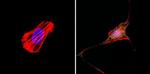 RAC1 Antibody in Immunocytochemistry (ICC/IF)