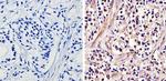 Androgen Receptor Antibody in Immunohistochemistry (Paraffin) (IHC (P))