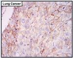 EGFR Antibody in Immunohistochemistry (Paraffin) (IHC (P))