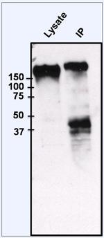 EGFR Antibody in Immunoprecipitation (IP)