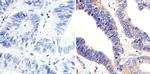 ARF1 Antibody in Immunohistochemistry (Paraffin) (IHC (P))