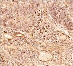 NTHL1 Antibody in Immunohistochemistry (Paraffin) (IHC (P))