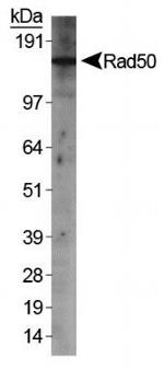 RAD50 Antibody in Western Blot (WB)