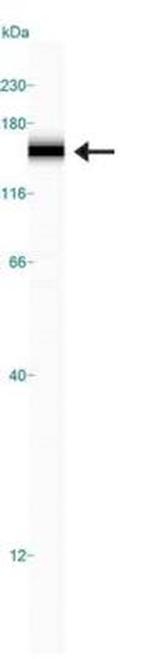 RAD50 Antibody in Western Blot (WB)