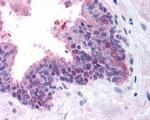 FANCD2 Antibody in Immunohistochemistry (Paraffin) (IHC (P))