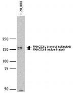 FANCD2 Antibody in Western Blot (WB)