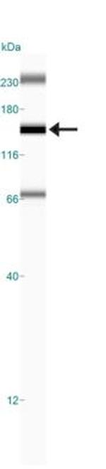 FANCD2 Antibody in Western Blot (WB)