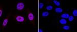 53BP1 Antibody in Western Blot (WB)